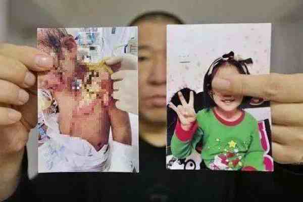 抚顺市回应6岁女童受虐案-抚顺虐童事件-第2张图片