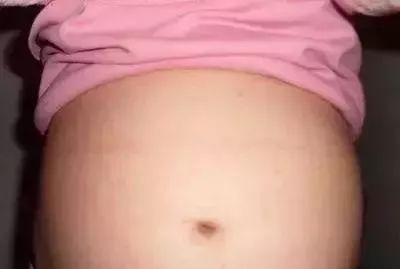 典型怀男孩肚子图片七个月（男宝宝肚型图片大全）-第3张图片