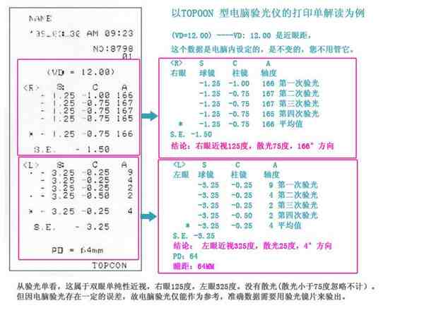 视力表怎么看（教你怎么看懂视力表和验光单？）-第3张图片