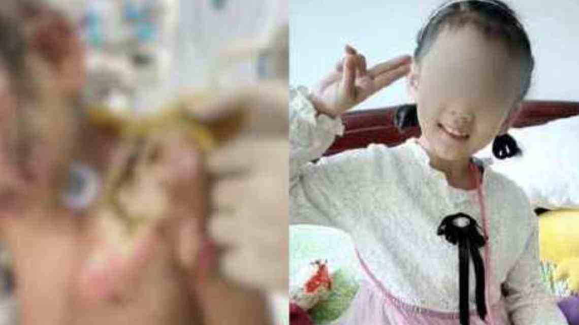 女童遭亲妈虐待险丧命惹众怒-6岁女童遭亲妈及其男友虐待-第3张图片