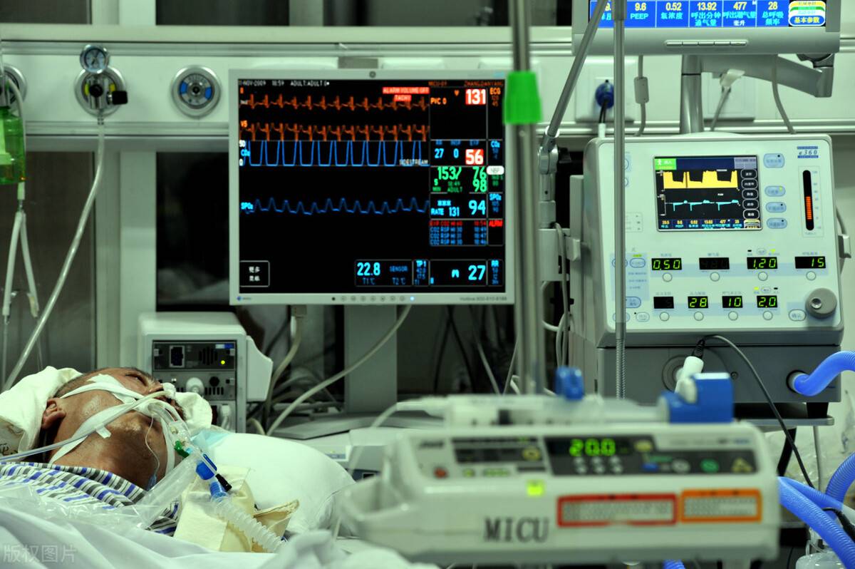 icu病房是什么意思（ICU到底是一个什么科室？）-第6张图片