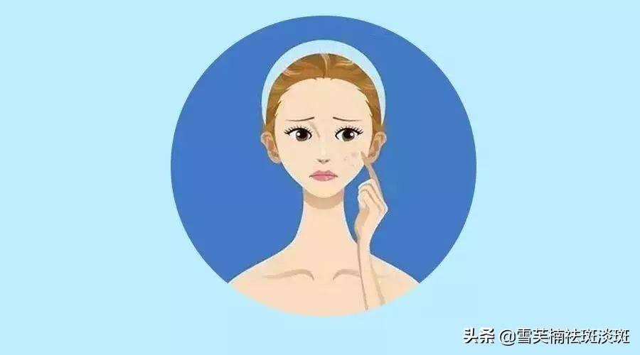 祛斑最好的方法(目前最有效果的祛斑方法)-第4张图片 祛斑最好的方法(目前最有效果的祛斑方法)-第4张图片