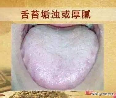 舌苔厚白是怎么回事（舌苔白腻是什么原因？）-第1张图片