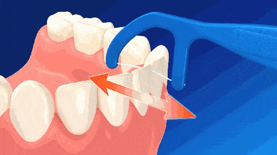 牙线怎么用（牙线的正确使用方法）-第2张图片
