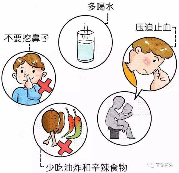 鼻子出血怎么止血？（流鼻血了该怎么办？）-第5张图片