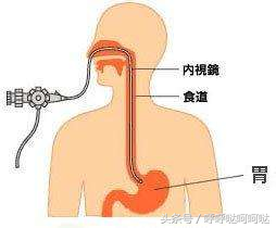 胃镜多少钱（做胃镜一般多少钱？）-第1张图片