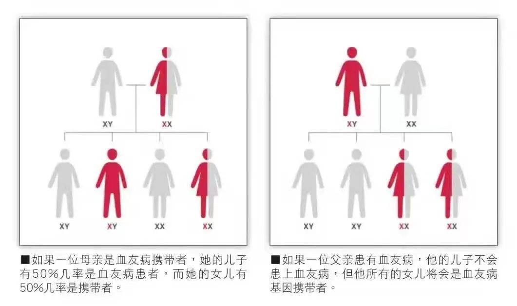 血友病是什么？（被称为皇室贵族病的血友病究竟是什么？）-第2张图片