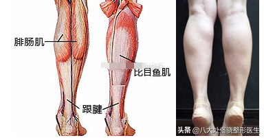 瘦腿针有副作用吗？（打瘦腿针有没有副作用呢？）-第5张图片