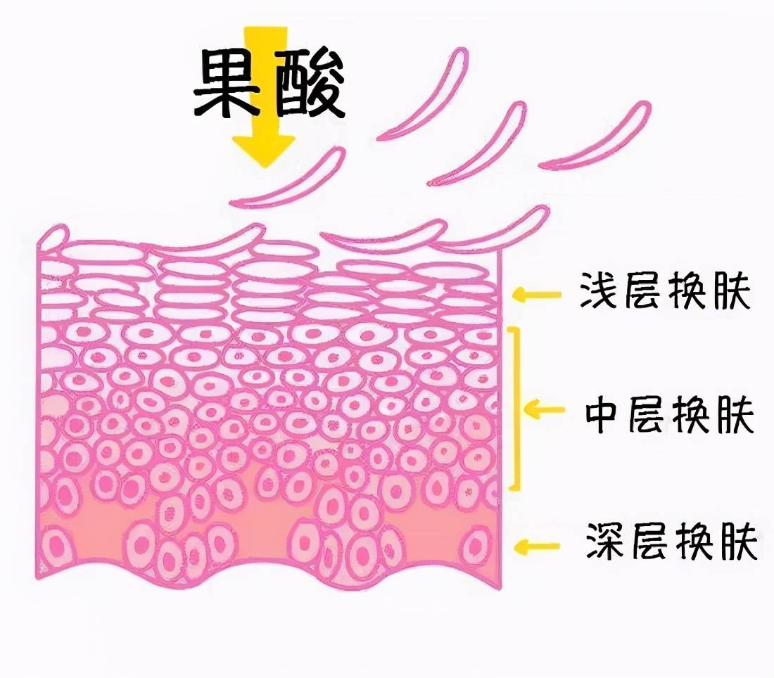 在家祛痘的小窍门（怎样去除痘痘？）-第3张图片