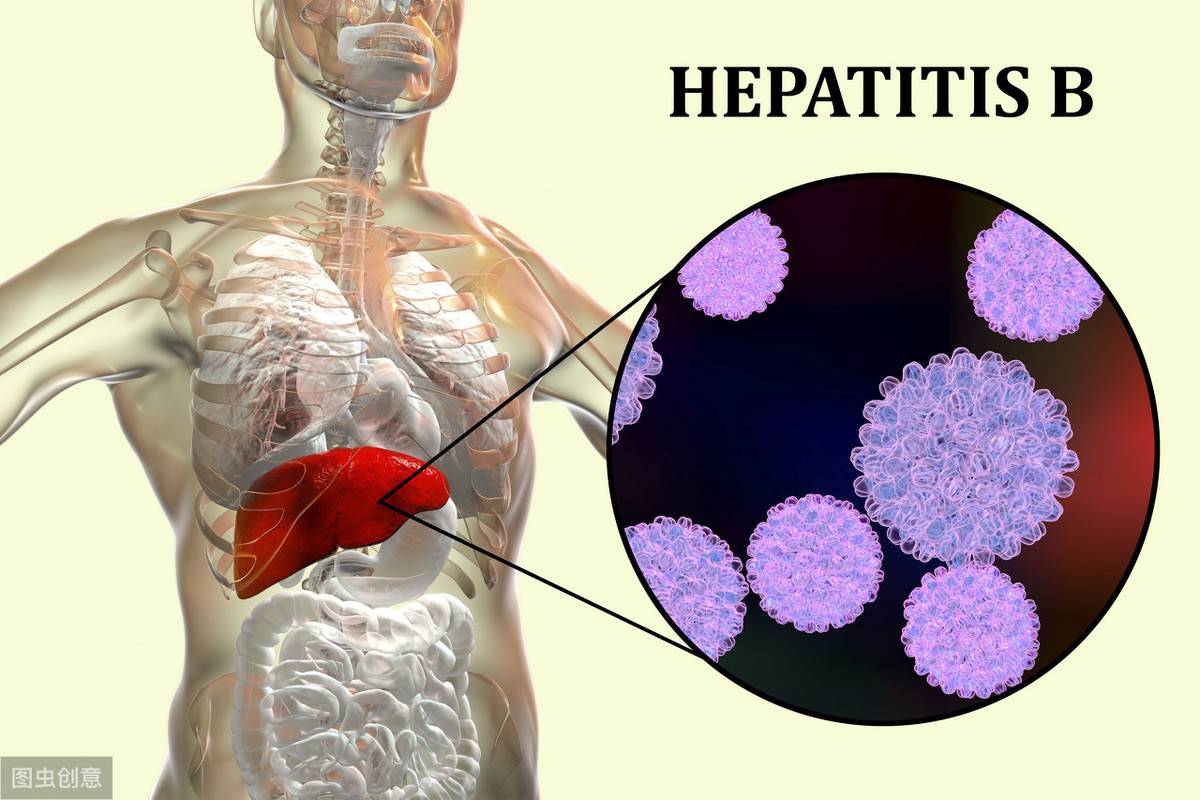 肝炎的表现（肝病的7个临床常见症状）-第1张图片