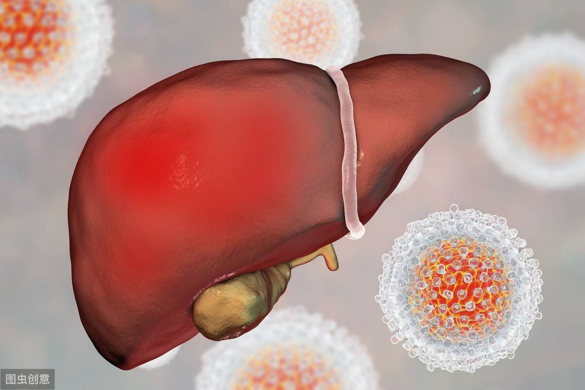 肝病什么症状？（肝病的7个临床常见症状）-第2张图片