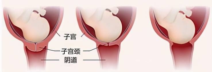 分娩前征兆（孕妈的产前征兆有哪些？）-第2张图片