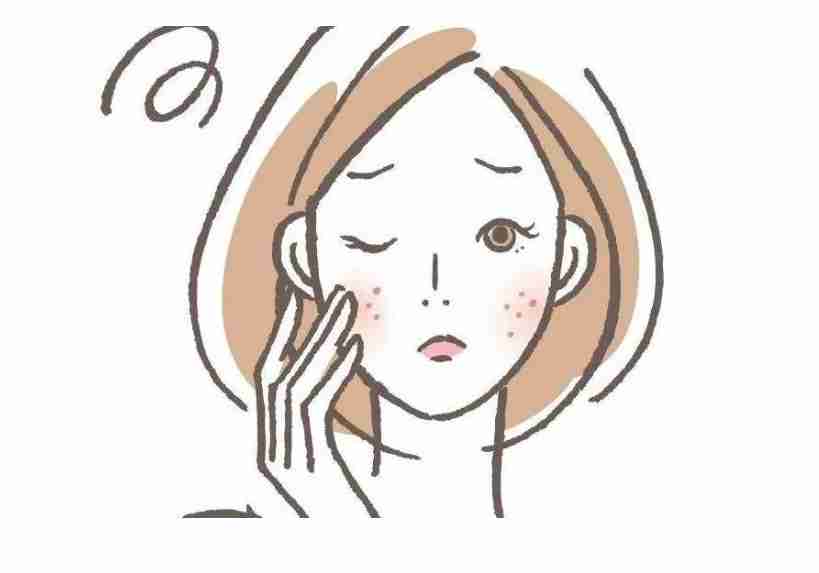 脸上皮肤过敏的症状（常见的过敏反应有哪些？）-第3张图片