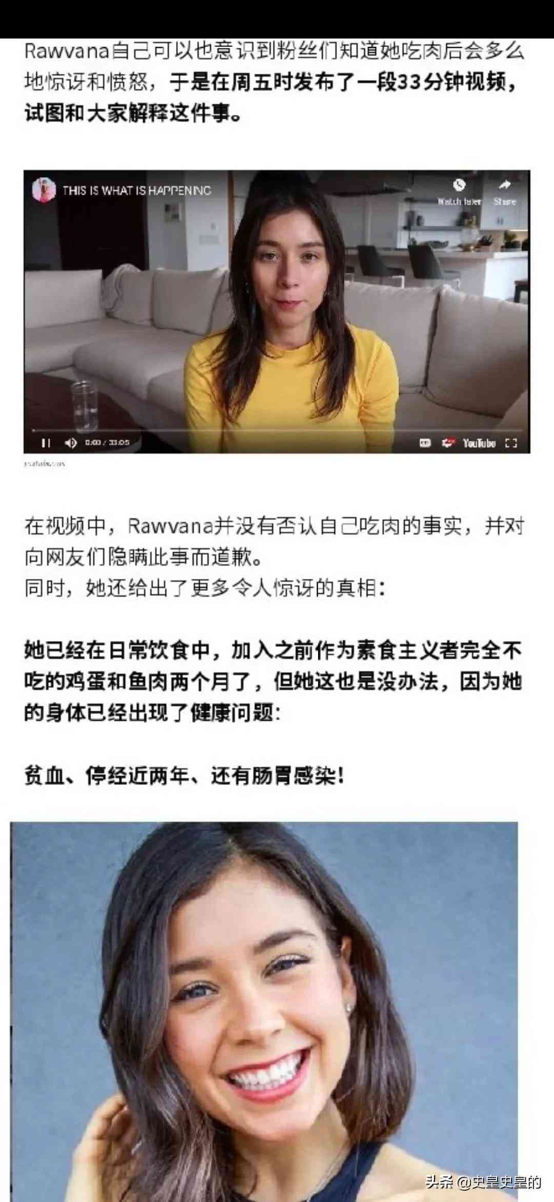 乔布斯手术后活了多久(乔布斯延长寿命)-第5张图片 乔布斯手术后活了多久(乔布斯延长寿命)-第5张图片