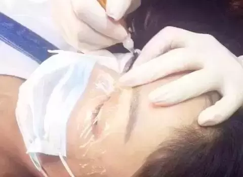 半永久美瞳线保持多久(做一个美瞳线多长时间)-第6张图片 半永久美瞳线保持多久(做一个美瞳线多长时间)-第6张图片