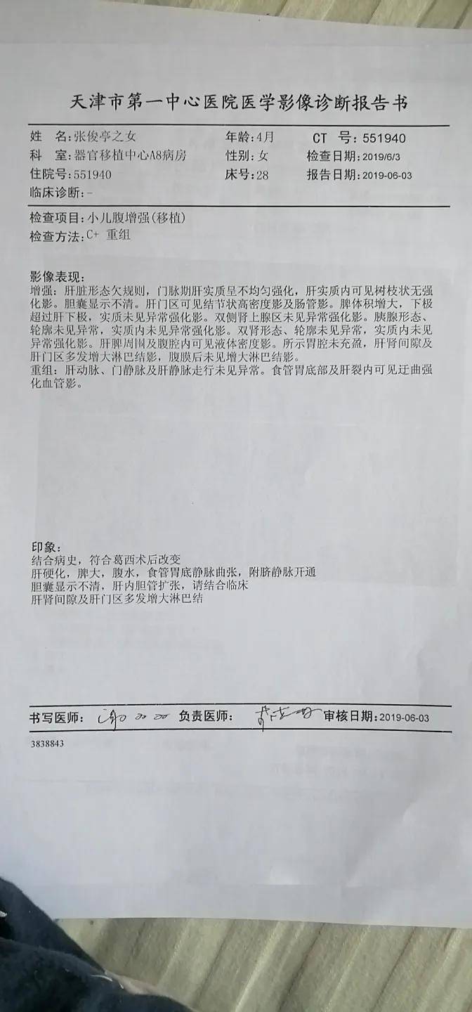 肝移植后能活多久(良性肝移植会不会影响寿命)-第9张图片 肝移植后能活多久(良性肝移植会不会影响寿命)-第9张图片