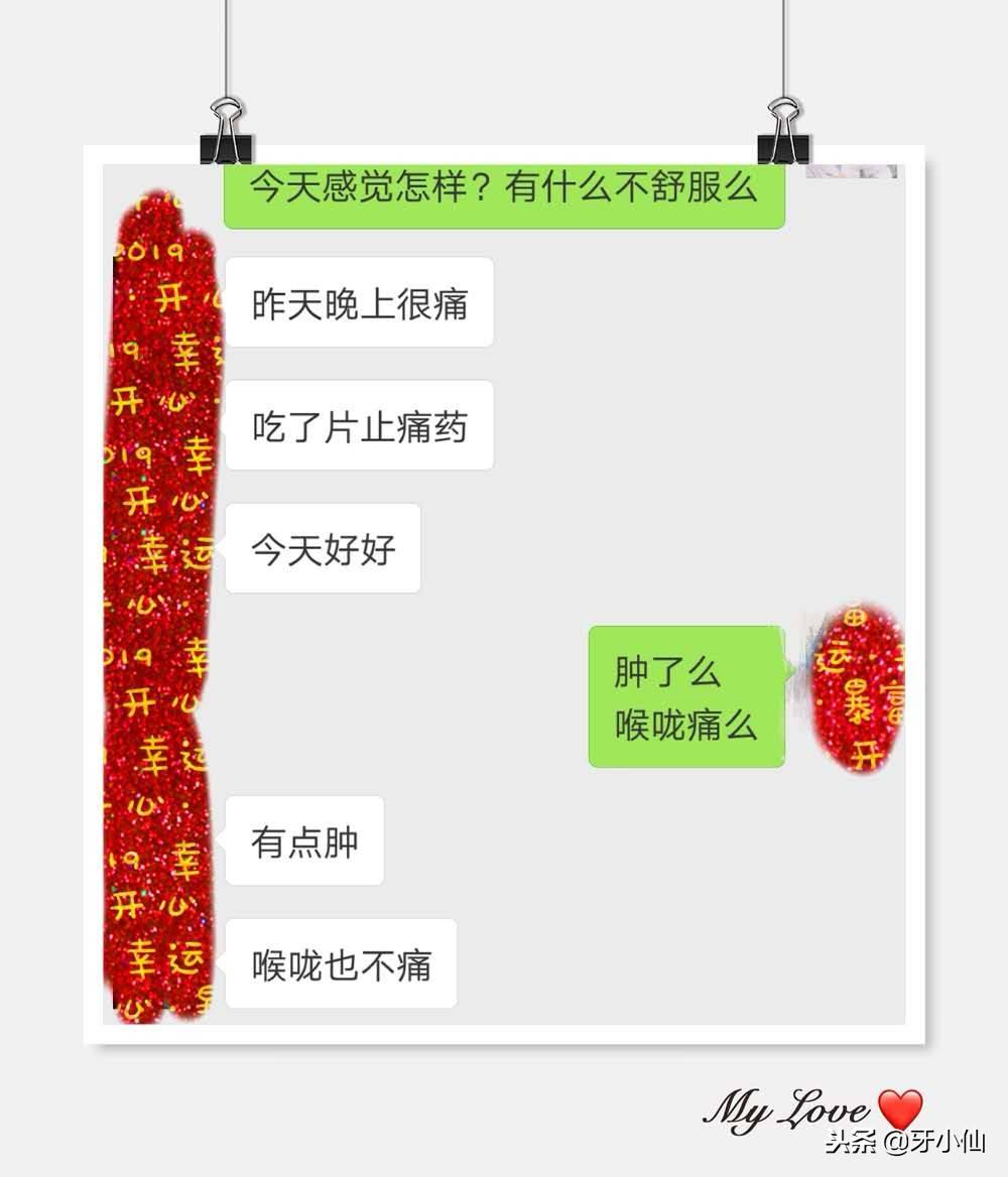 拔牙需要多久(正常拔牙需要多少时间)-第5张图片 拔牙需要多久(正常拔牙需要多少时间)-第5张图片