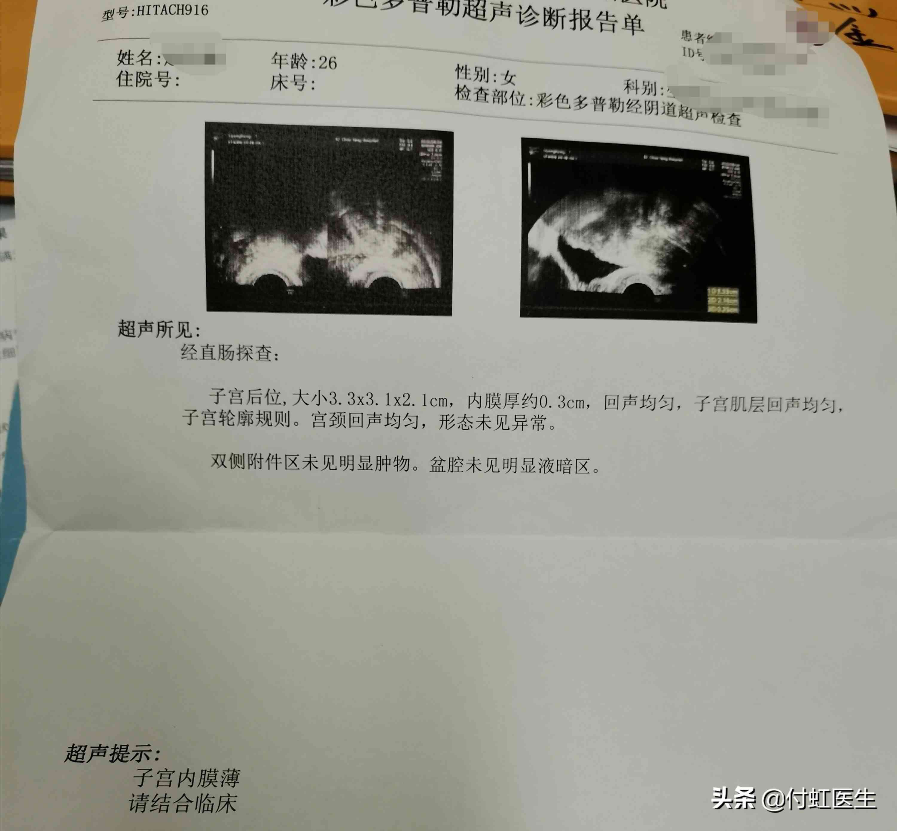 吃黄体酮多久来月经(子宫内膜9mm是薄还是厚)-第3张图片 吃黄体酮多久来月经(子宫内膜9mm是薄还是厚)-第3张图片