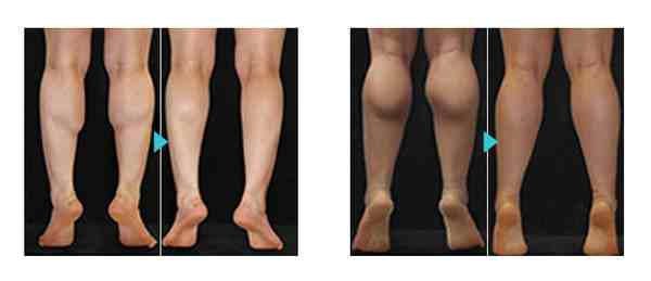 瘦小腿的最快方法（快速的瘦小腿办法）-第2张图片
