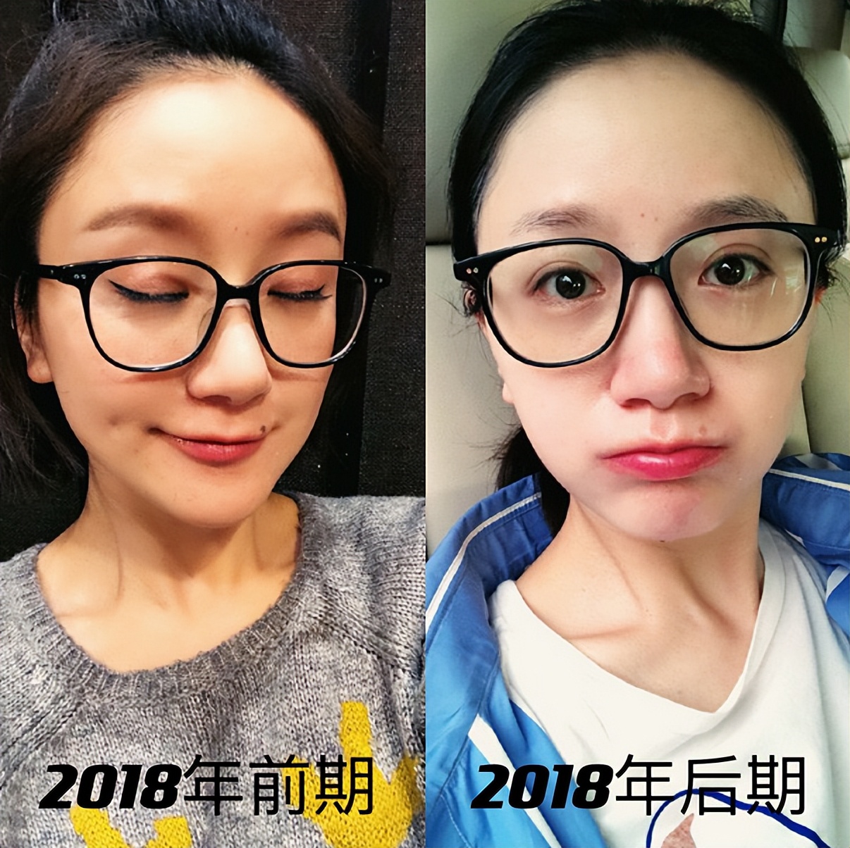 李倩个人资料简介(被点了美人痣)-第30张图片 李倩个人资料简介(被点了美人痣)-第30张图片