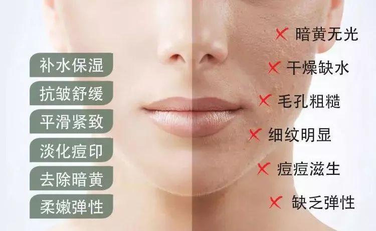 芦荟胶对痘痘和痘印有效果吗(每天晚上坚持涂芦荟胶的效果)-第27张图片 芦荟胶对痘痘和痘印有效果吗(每天晚上坚持涂芦荟胶的效果)-第27张图片