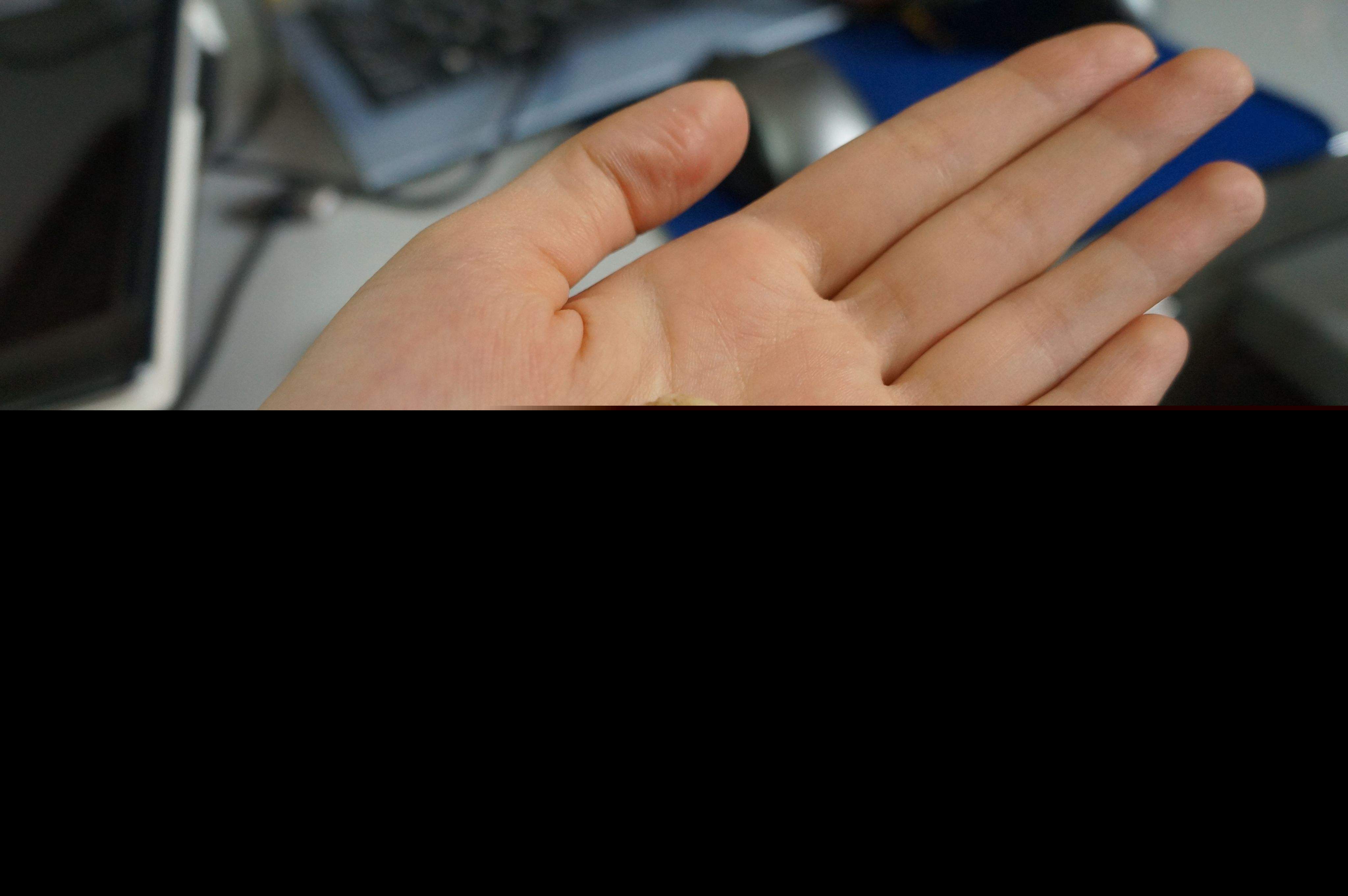 怎么判断猫有耳螨还是耳朵脏（猫耳朵脏和耳螨的区别）-第1张图片