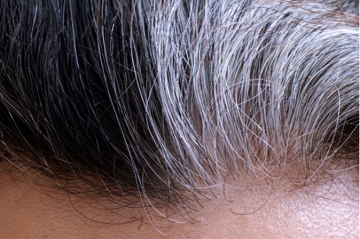 染黑色头发伤害大吗（染发剂对于头发都有哪些危害）-第2张图片
