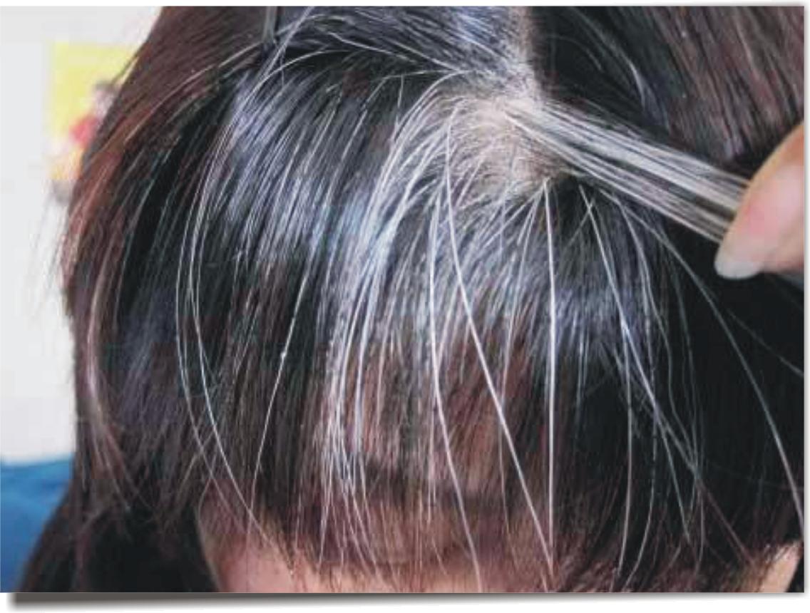 染黑色头发伤害大吗（染发剂对于头发都有哪些危害）-第4张图片