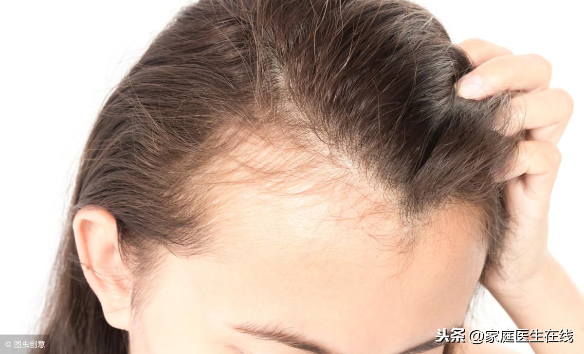 或许能挽救发际线头发一把把的掉(头发掉的厉害怎么办)-第3张图片 或许能挽救发际线头发一把把的掉(头发掉的厉害怎么办)-第3张图片