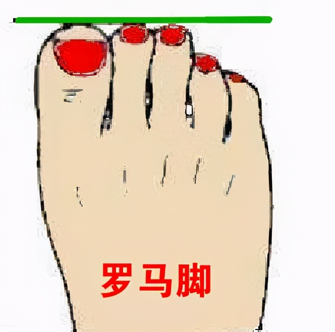 二拇脚趾头长有啥说法（俗语说二拇脚趾头长是怎么回事）-第4张图片