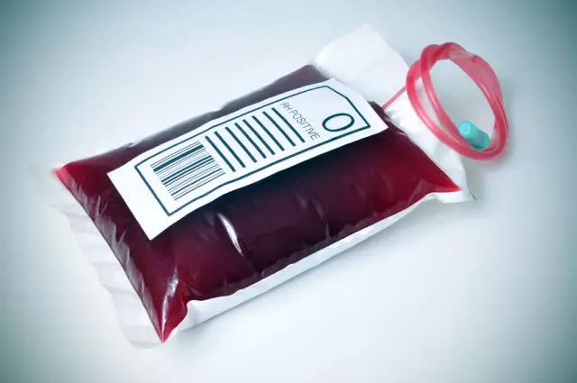 o型血的人容易得什么病(血型能看出一个人最容易得什么病吗)-第9张图片