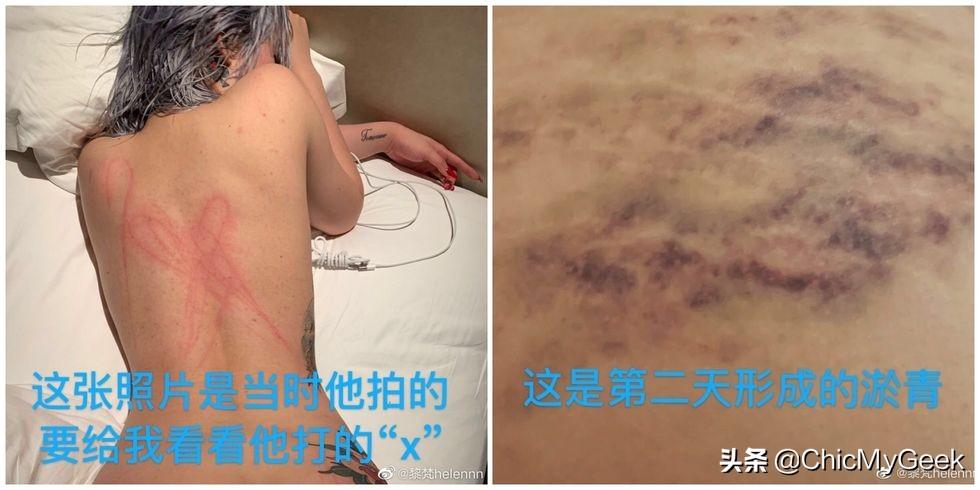 屈楚萧事件是什么(屈楚萧)-第11张图片 屈楚萧事件是什么(屈楚萧)-第11张图片