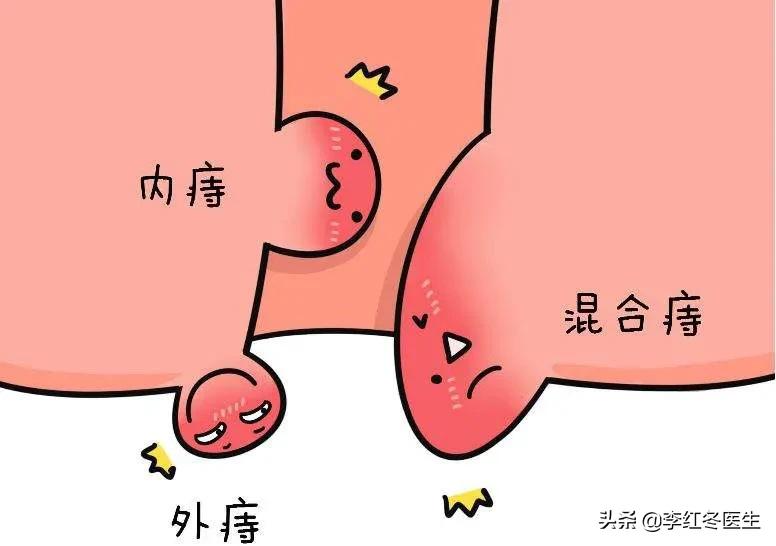 哪三种人不能吃鸽子（哪些体质的人是不能吃鸽子肉的）-第6张图片