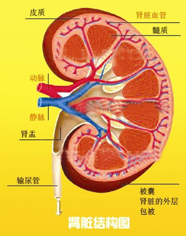 35岁男子尿酸高达860，肾衰入院-第6张图片