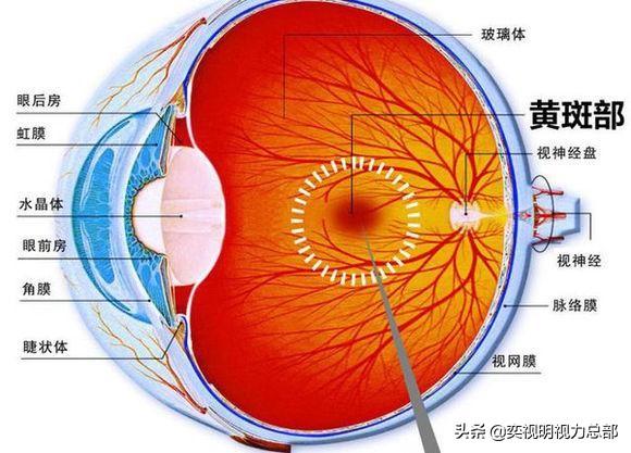高度近视的人不适合做什么?-第4张图片 高度近视的人不适合做什么?-第4张图片
