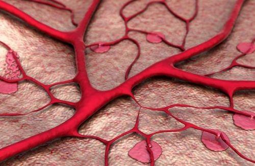软化血管的5大误区您知道几个？提醒：延缓血管硬化需注意4点-第7张图片