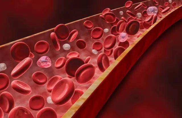 软化血管的5大误区您知道几个？提醒：延缓血管硬化需注意4点-第3张图片