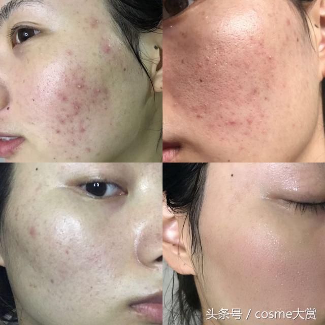 用舒肤佳洗脸好吗?-第4张图片 用舒肤佳洗脸好吗?-第4张图片