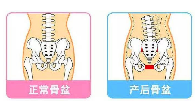 少女胯和妈妈胯有什么区别?-第3张图片 少女胯和妈妈胯有什么区别?-第3张图片