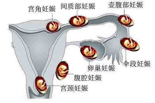 验孕棒一深一浅是怀孕了吗（什么时候能测出是否怀孕）-第7张图片