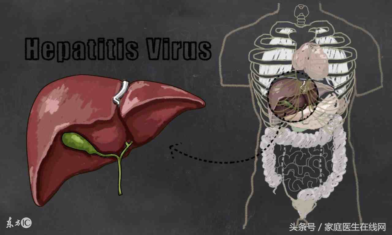 脂肪肝如何消除（检查出脂肪肝该怎么治）-第1张图片
