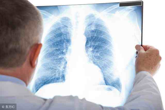 肺病有哪些（肺病有哪些最常见的有这六种）-第2张图片