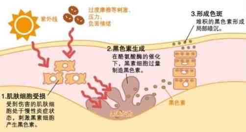 开塞露可以祛斑吗（开塞露可以祛斑祛皱？）-第3张图片