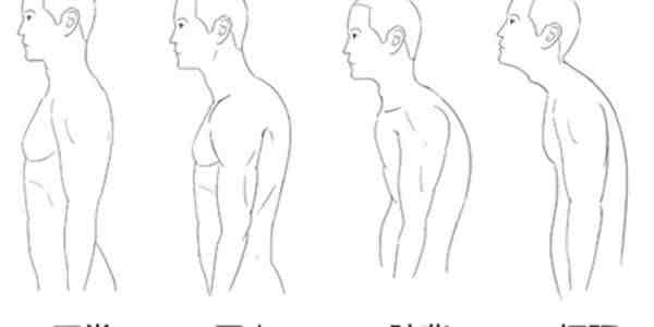 驼背怎么矫正（驼背有哪些矫正方法？）-第1张图片