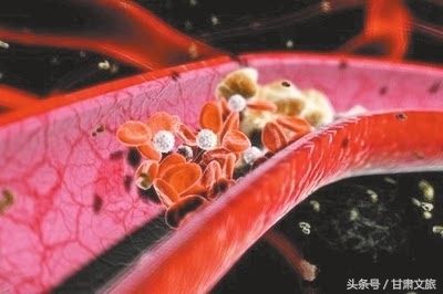 不喜欢喝水（不喜欢喝水？那么这五种疾病要注意了！）-第4张图片