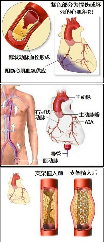心血管系统（心血管系统详解知识点）-第12张图片