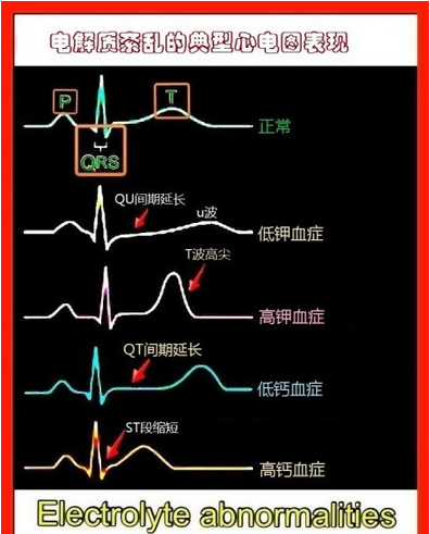 心血管系统（心血管系统详解知识点）-第15张图片