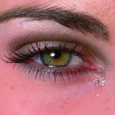 眼睛哭肿了怎么快速消肿（7个小妙招快速消肿）-第2张图片