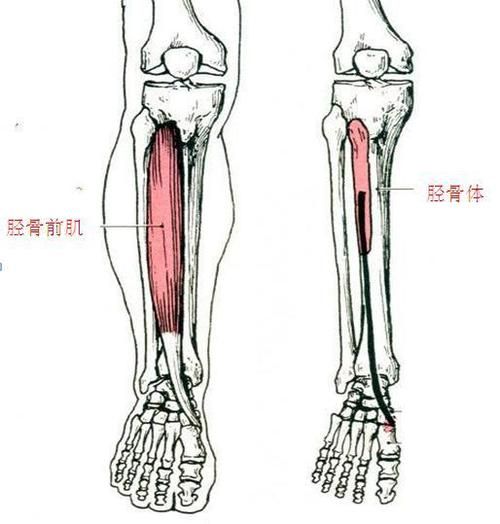 小腿骨膜炎的症状（小腿骨膜炎的主要症状有哪些？）-第5张图片