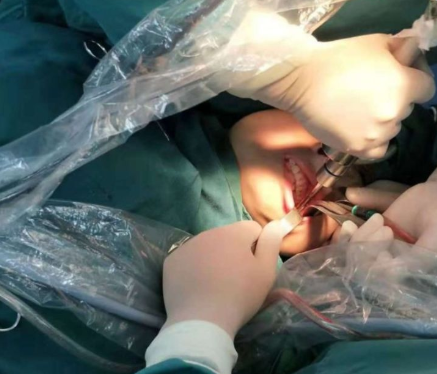 削骨手术过程是怎样的（ 神秘的“磨骨”手术）-第3张图片